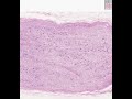 Shotgun Histology Sympathetic Ganglion
