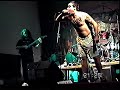 DISPLASIA - DESTRUYE EL FASCISMO
