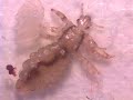 Louse