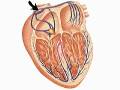 The Pacemaker of the Heart