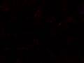videos de Jacky and Anqiie´zz Crazy Style