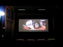 Aspect Ratio Change on the SuperKontrast