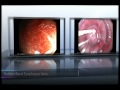 Gastrointestinal Endoscopy