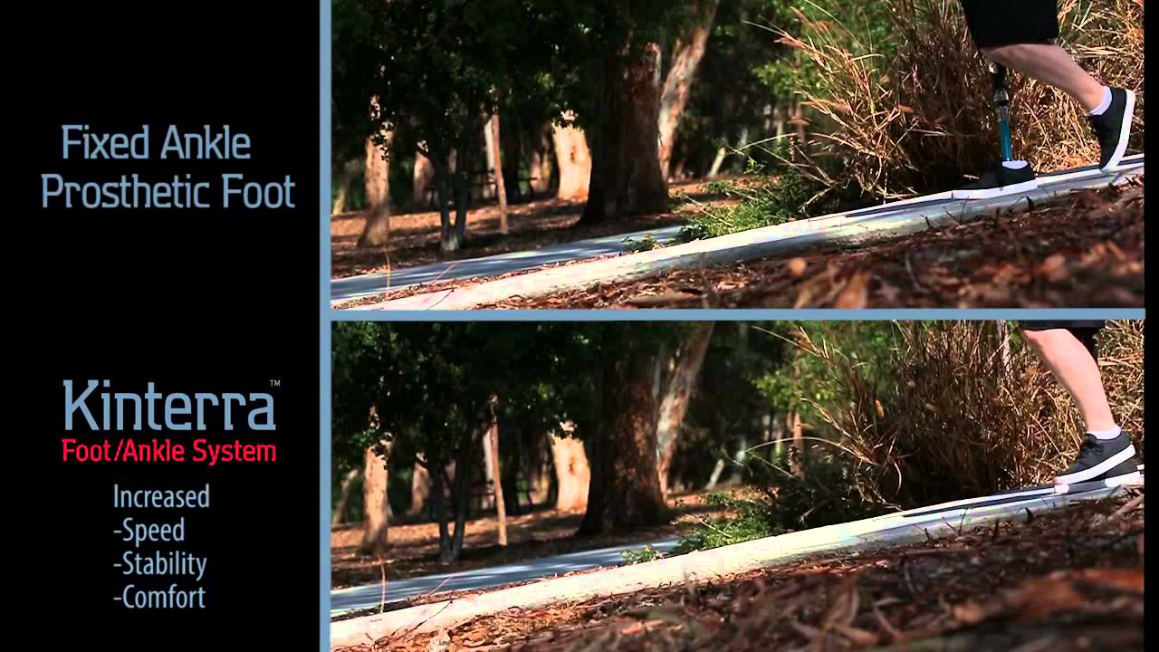 Kinterra foot/ankle system
