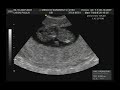 Poroto tiene dos meses (Parte 1) Poroto tiene dos meses (Parte 1)
