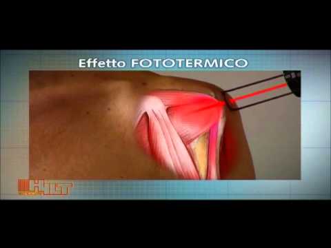 Hilterapia<sup>®</sup>