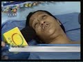 Daños que causa en la salud el uso de cloro Gas Daños que causa en la salud el uso de cloro Gas