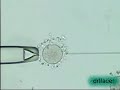 ICSI (IVF IMAGES) ICSI (IVF IMAGES)