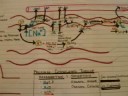 Respiratory Alkalosis