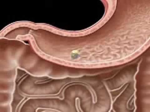 liver - Liver Video.