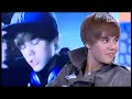 justin se levanta el cabello y deja al descubierto su frente ohsi