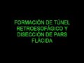 banda gástrica