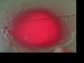 Thumbnail #1