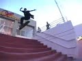 Braden Wheeler PRK part Braden Wheeler PRK part