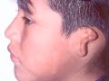 in 2007, filmmakers lisamarie costabile and mark larson followed dr. thomas romo and the little baby face foundation as they treated peyton sherrill, a boy from alabama who was born with microtia; he was born without his right ear.

the little baby face foundation is a new york city-based organization of surgeons and medical providers who volunteer their time and expertise to treat children from around the world born with facial birth defects. dr. thomas romo, a renowned plastic surgeon, started the foundation in 2002.