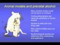 Fetal Alcohol Syndrome & Fetal Alcohol Effects Video Part 2