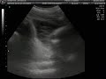 3D/4D Ultrasound at 29 Weeks Pregnant! (Part 1)