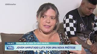 Pedido de ajuda em São Manuel: jovem amputado luta por uma nova prótese