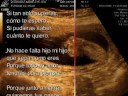 Este video es una edición super especial de la Ecografía Morfológica de mi pequeño. (Eco 4D). Espero la disfruten