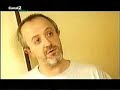 Frontera Social. Enfermedades raras. osteogenesis. 3/3