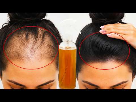 O cabelo cresce loucamente e não cai! Esta é a receita mais poderosa! (Sabia disso?)