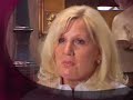 http://www.parkercenter.net/-  this patient's personal account of her experiences with eyelid surgery, new jersey plastic surgeon, dr. paul parker.  she expresses her appreciation for a wonderful surgery and wonderful experience at parker center for plastic surgery, new jersey.  

hear this patient describe how comfortable she was with dr. parker, 