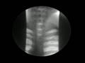 Video X Ray