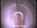 visiport breedband