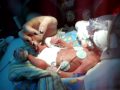 Rozthorne 2 pound Preemie baby born at 28 weeks