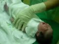 Operasi sectio caesar Alyssa Zalfa Rahadian #10