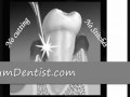 Laser Gum Surgery.flv