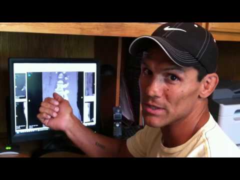 how to define athleticism