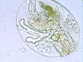 Rotifer, Testudinella patina.wmv