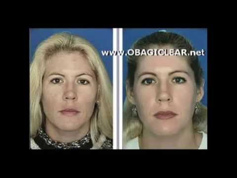 how to apply obagi clear