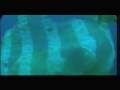 The Garbage Patch