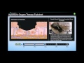 Patient Education Simulation for Hyperbaric Oxygen Therapy
