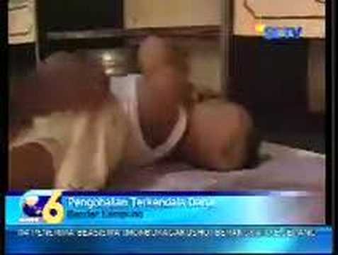 Bayi Tanpa Anus