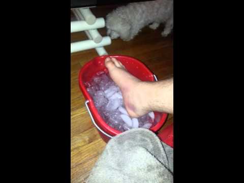 how to relieve sprained ankle