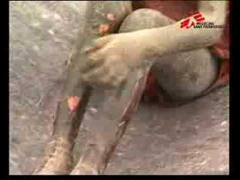 Image de prévisualisation YouTube