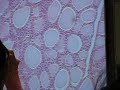 Thyroid Gland
