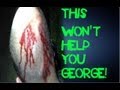 New Photo Shows Zimmerman's Bloody Head ...