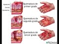 Quemaduras isarel langarica arreola