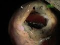 Fooled by Nature - Lungfish