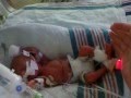 25 week preemie's journey