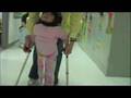 Mieko-on-crutches-20