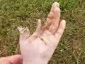 M-80 explodes a severed arm (Aftermath)
