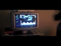 Ultrasound Growth Scan- 29 Weeks