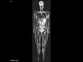 Full Body MRI