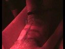 \"The Depilation of the Body\"