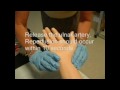 Arterial Blood Gas Sampling Procedure